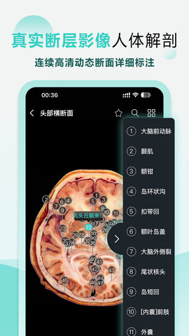 掌上3D解剖原版图4