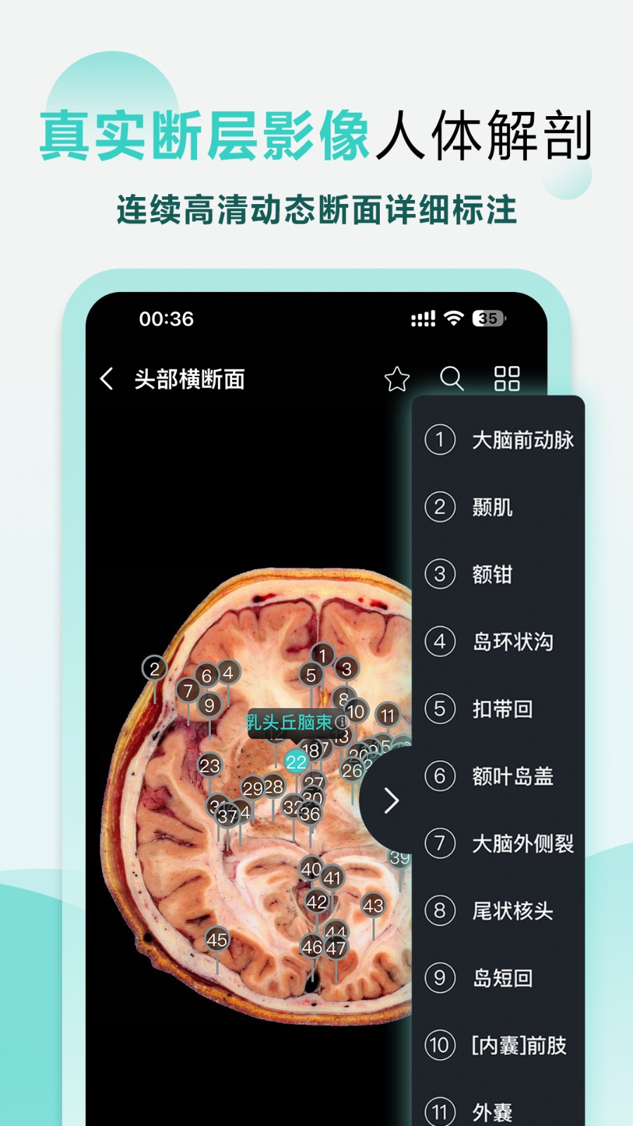 掌上3D解剖免费原版图4
